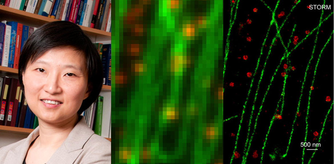 Xiaowei Zhuang vinner Lennart Nilsson Award 2017 och en jämförelse mellan STORM och konventionell mikroskopi