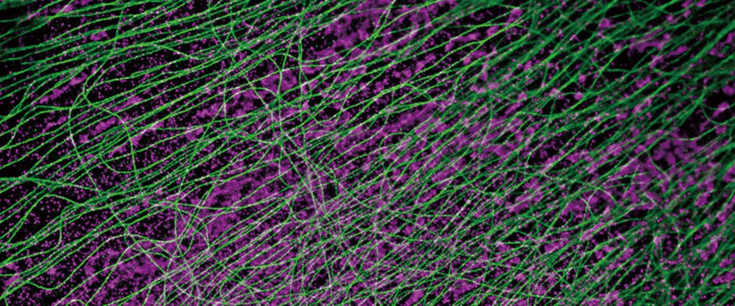 Tubulin TOMM20_CV-1Cells
